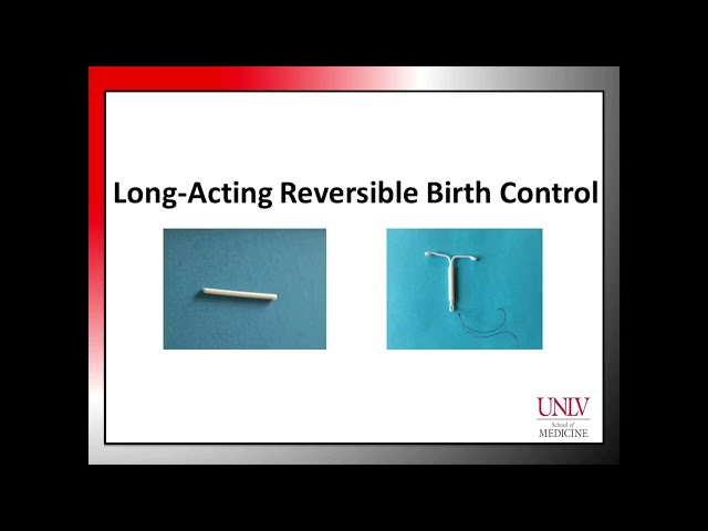 BC Module 1.3 Female Long Acting Reversible Birth control